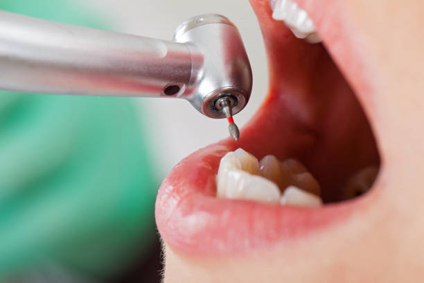 Best Emergency Dental Care for Trauma or Injury in Yorketown, NJ